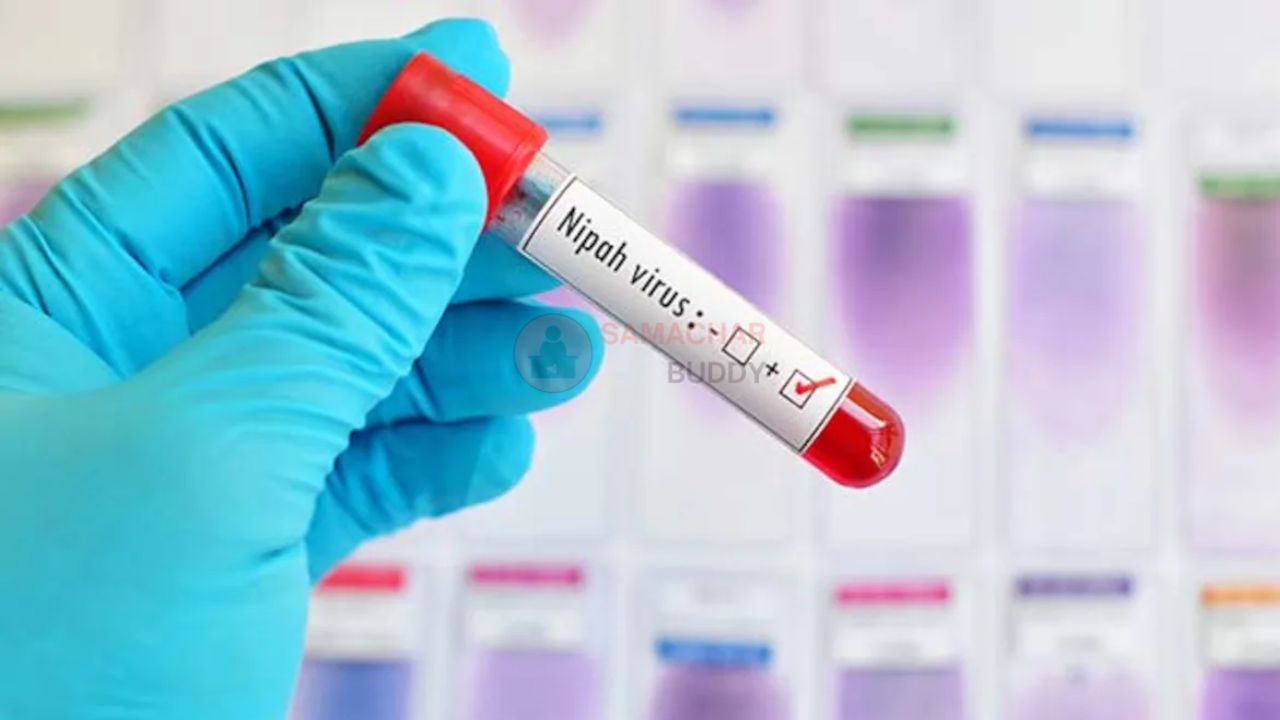 Nipah Virus