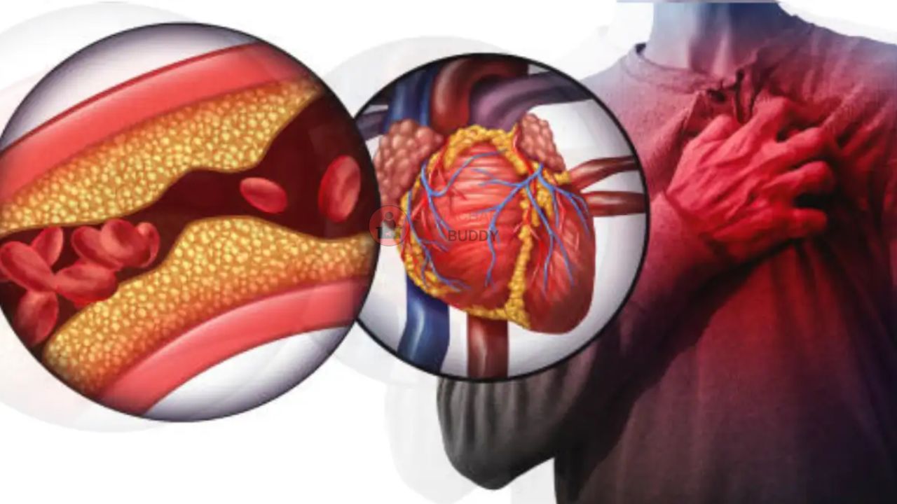 Morning Heart Attack Risk